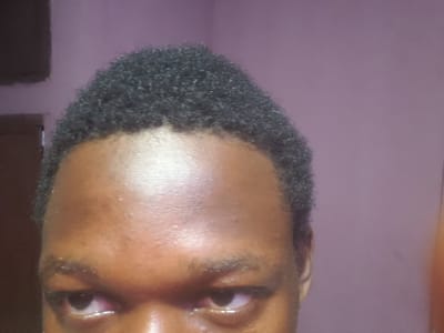 The image is a close-up portrait of a person's face, focusing on their forehead, eyes, and the top of their head with curly black hair. The background is a plain, solid color, appearing to be a pale purple or lavender. The lighting creates a slight sheen on the person's forehead, suggesting it is well-lit. The details are sharp enough to discern the texture of the hair and the skin, as well as the shape of the eyes and eyebrows. There is no indication of the specific location within Iganmu, Nigeria, or any environmental context beyond the plain background.
