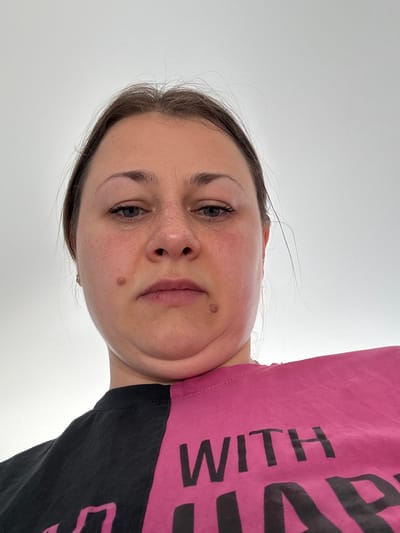 The image shows a close-up, low-angle shot of a woman's face and upper torso, taken against a plain, bright background that appears to be a wall or sky. The woman has light brown hair, tied back, and her face is turned towards the camera. She has a mole on her right cheek and a reddish hue on both cheeks, suggesting potential irritation or blushing. Her lips are slightly parted, and she has visible under-eye circles. The lower part of the image shows her wearing a split-color t-shirt, half black and half bright pink, with bold black lettering on the pink portion that appears to read "WITH" followed by other obscured text. The overall lighting is even and bright, with no discernible shadows. The image does not contain any information that would allow for its location to be identified as Uyutnoye, Ukraine, or any other specific city.