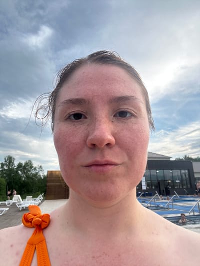 A young woman, with fair skin showing redness and freckles, poses for a selfie outdoors. Her hair is dark and appears damp, with strands falling across her forehead. She is wearing an orange bikini top, adorned with a decorative knot on the strap. The background suggests a recreational setting, possibly a water park or spa, with swimming pools visible and lounge chairs arranged on a wooden deck. In the distance, a modern building with large windows and trees line the perimeter. The sky is overcast with dramatic clouds. The woman's facial expression is neutral.