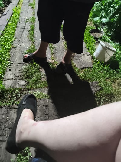 The image depicts two individuals' legs and feet positioned on a wooden pathway bordered by lush green grass. The person in the foreground has their left leg angled upwards, showing a bare foot with what appear to be red marks or abrasions on the skin. They are wearing a black slip-on shoe. The second person, partially visible in the background, stands with their legs slightly apart, wearing black shorts and dark sandals on their feet. A long shadow is cast by this individual onto the pathway. To the right of the pathway, near some dense foliage, are two containers: a shallow metal pan with dark contents and a white bucket. The overall setting suggests an outdoor environment, possibly a backyard or a rural path. The presence of the wooden walkway and the vegetation indicates an area with some natural growth. The lighting suggests it might be late afternoon or early evening, or a shaded area. The image doesn't provide specific landmarks or context to pinpoint a location within Il'mino, Russia, beyond it being an outdoor scene with typical elements found in many locations.