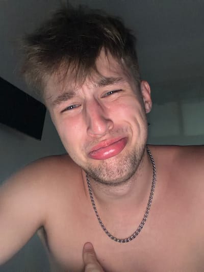 A young man, shirtless and wearing a silver chain, is captured in a close-up, dimly lit selfie. His hair is disheveled, and he squints at the camera with a contorted facial expression, his lips pursed and his tongue slightly visible. His right shoulder and upper chest are visible, with a faint red mark on his chest where his hand is resting. The background is dark and appears to be an indoor setting, possibly a bedroom. There is no discernible location or context that places this image in Vanino, Russia.