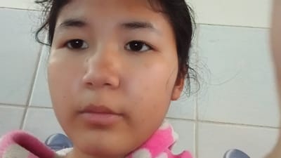 This is a close-up, selfie-style portrait of a young girl, likely of Asian descent, in an indoor setting. She has dark hair, which is somewhat messy and appears to be pulled back loosely. Her eyes are dark and wide open, looking directly at the camera. Her skin is fair with some slight discoloration on her cheeks, possibly freckles or sunspots. She has a neutral expression, with her mouth slightly closed.
She is wearing a pink and white polka-dotted garment that appears to be a soft, fuzzy material, possibly a robe or sweater, around her neck and shoulders. In the background, a tiled wall is visible. The tiles are light-colored, possibly white or a very pale gray, and laid in a grid pattern. The lighting suggests it is daytime, but there are no external windows visible to indicate the time of day or weather. The setting appears to be a home or a similarly casual indoor environment, possibly a bathroom given the tiled wall. No specific activity is apparent beyond the act of taking a photograph. There is no visible text in the image. The overall impression is a casual, personal snapshot.