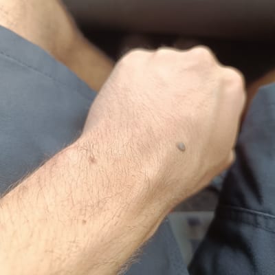 The image shows a close-up of a person's forearm and clenched fist, with blue fabric visible in the foreground and background. There are a few moles on the skin of the forearm. The scene is undated and the location in Lyubimets, Bulgaria, is not evident from the image itself.