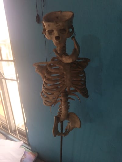 An indoor scene is depicted, potentially located in Warri South, Nigeria. The primary subject is a human skeletal torso model, constructed from a light-colored, possibly plastic material, positioned centrally and facing slightly towards the viewer's right. The model includes an intact rib cage, a visible spine, and complete pelvic bones. The skull is present, featuring an open cranium and a detached mandible resting on the upper cervical/thoracic area. The model is supported by a slender, dark metal pole extending vertically from its lower pelvis, disappearing out of frame downwards. To the left, a window with multiple panes admits bright, natural light, causing a significant glare. Below the window, a flat surface displays several white papers and a partially visible multicolored object. The background consists of a uniformly painted light blue wall. Dark, thin cables or wires are visible hanging from the upper left corner of the frame. No individuals are present.