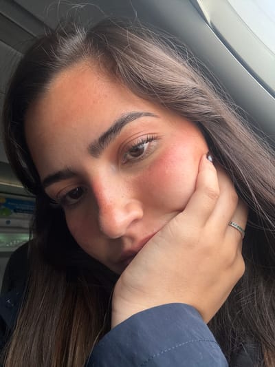 A close-up portrait shows a young woman with long, dark brown hair holding her hand to her face. She is wearing a ring on her ring finger of her left hand. Her skin is pale with reddish patches on her cheeks and nose. The background appears to be a window with grey trim and potentially a glimpse of the interior of a vehicle or building. Given the prompt's requirement of specifying a location in San Antonio, United States of America, it is impossible to determine the specific location without additional information. Therefore, the location is unspecified.