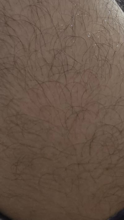 This close-up image shows human skin with sparse, dark hair. The skin appears to be a light brown or tan color. Some small, white specks are visible on the skin's surface, possibly lint or dust. The texture of the skin is visible, with a slightly uneven surface. The lighting suggests it could be indoors or outdoors with diffused light, as there are no strong shadows. The context of Khujand, Tajikistan, offers no specific visual cues within the image itself, as it focuses solely on a small section of skin. No objects, scenes, or specific activities are discernible beyond the presentation of skin. There is no visible text in the image.