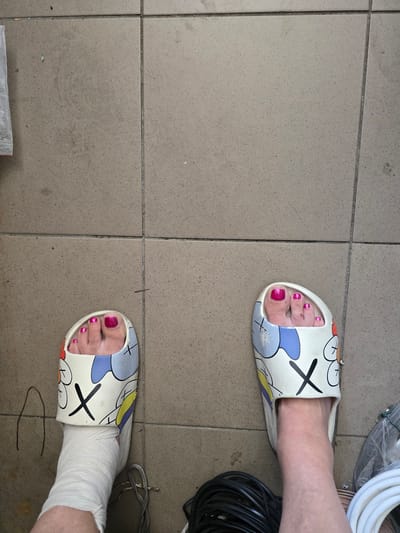 The image shows a person's feet wearing decorative slippers with cartoon characters and "X" markings. One foot is bare, while the other is bandaged from the ankle down, suggesting an injury. The feet are placed on a tiled floor, which appears to be outdoors or in an industrial setting, given the presence of coiled cables and pipes in the background. The lighting suggests daytime. The person is wearing bright pink nail polish on their toes. The overall scene is ordinary, focusing on the feet and their accessories, but the bandage introduces an element of concern or an ongoing situation. The location context indicates Nova Kakhovka, Ukraine.