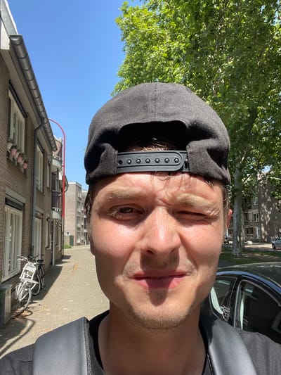 The media file is a selfie taken outdoors in Venlo, Netherlands. The subject is a person wearing a black baseball cap. The person's face is partially visible, with one eye closed and the other open. The background includes a brick building, trees with green leaves, and a clear blue sky, suggesting it is daytime with good weather. A street with a brick sidewalk is also visible, with a parked bicycle and a car. The image appears to be taken from a low angle, looking up towards the subject. The overall mood seems casual and candid. There is no visible text in the image.