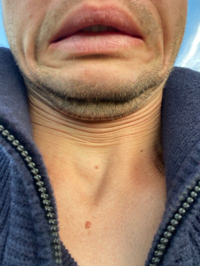 The image shows a close-up of a person's mouth, chin, and neck, wearing a dark blue zippered garment. The person has stubble on their chin and neck. The skin on the neck is wrinkled. There are two moles visible on the neck. The background shows a blurred blue sky with some wispy white clouds. The image is taken from a low angle, looking upwards. No specific location in Oktyabr'skii, Russia is identifiable from the image.