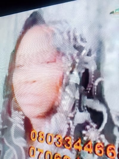 The media file presents a close-up shot of a person's head and upper torso, likely captured from a screen due to visible horizontal lines and pixelation. The subject's face, positioned on the left side, appears to be light-skinned with reddish-orange undertones. Their eyes are closed or looking downwards, suggesting a neutral or contemplative expression. The head is tilted, and a dark, indistinct shape, possibly hair or a head covering, is visible on top.
The background is abstract and textured, composed of light grey and darker tones, resembling patterned fabric or a blurred environment. In the foreground, bold orange-gold numbers are overlaid across the lower portion of the image. The first visible line of numbers is "080334466", and beneath it, a second line begins with "0706". A small, triangular logo or emblem, featuring green and white colors, is faintly visible in the top right corner. No specific activity is depicted. There are no direct visual cues within the image to indicate the specified location of Chiranchi, Nigeria, nor can the time of day or weather be determined.