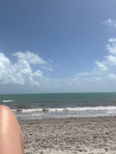 The image shows a beach scene, likely on Key Biscayne in the United States. The sky is mostly blue with scattered white clouds. The ocean is turquoise-green with small white waves breaking onto the shore. The beach consists of sand that is a light gray color. In the lower right corner, a portion of a human leg is visible.