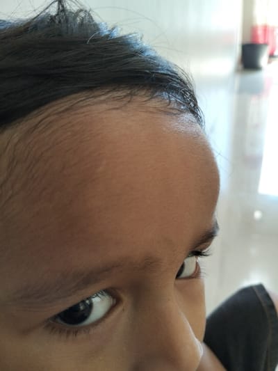 A close-up shot captures a person's face, predominantly the forehead and eyes. The smooth, brown forehead is in focus, with fine hairs along the hairline. Below, the eyes are dark and reflective, gazing slightly upwards and to the side. The skin appears to be healthy. A small black garment is visible in the lower right corner, suggesting the person is wearing clothing. The background is blurry, hinting at a bright, indoor setting.