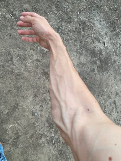 The image shows a close-up view of a person's arm and hand. The arm is extended, with prominent veins visible on the surface of the skin. The hand is relaxed, with fingers slightly curled. The background is a rough, gray surface, possibly dirt or gravel. There is no indication of the location being Cairaclia, Moldova.