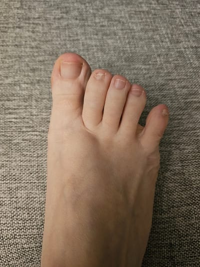 The image shows a close-up view of a person's left foot, resting on a grey textured surface, likely fabric. The foot is positioned with the toes pointing upwards and slightly to the left. The skin tone is fair. The toes are visible, with fingernails that appear unpolished and slightly irregular. The big toe on the left has a relatively smooth nail. The second toe's nail is slightly chipped. The third, fourth, and fifth toes show similar nail conditions, with some apparent roughness or unevenness. There is a slight callous or thickened skin visible on the side of the fourth toe. The background consists of a grey, woven fabric with a subtle pattern. There are no other identifiable objects or individuals in the frame. The image is well-lit, allowing for clear detail of the foot's texture and the condition of the toes and nails. No specific location in Mäntsälä, Finland, can be determined from the visual information provided.