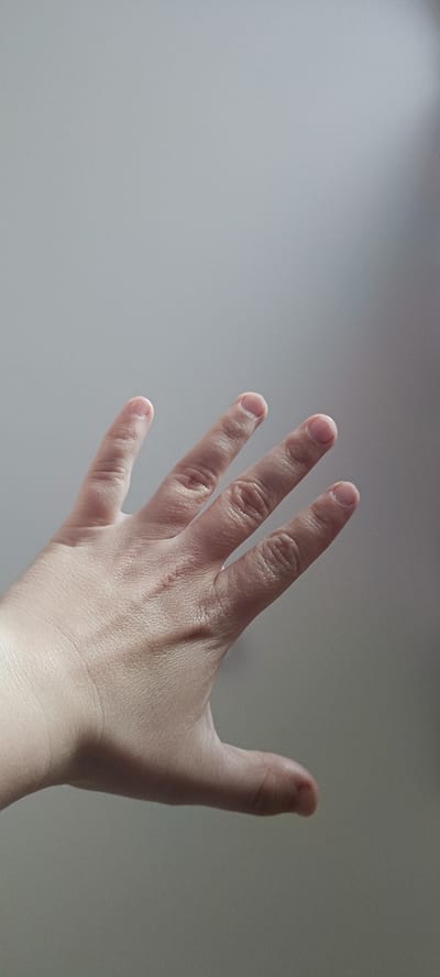 A close-up, medium-shot photograph shows the back of a person's left hand, palm facing upwards and fingers splayed outwards against a plain, light gray background. The hand appears to be that of an adult. The fingers are slightly curved and separated, with visible knuckles and creases. There is a faint, thin scar visible across the back of the hand, spanning from between the ring finger and the middle finger towards the base of the index finger. The lighting is soft and diffused, creating subtle shadows that highlight the texture of the skin. No specific location within the city of Хохлы, Russia, can be determined from the image.