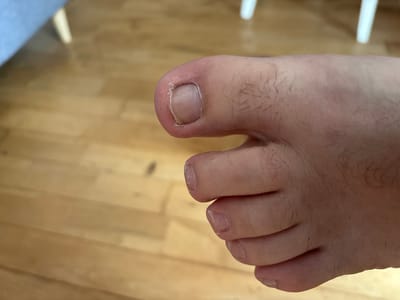 The image shows a close-up view of a person's foot, specifically the toes and toenails. The foot is resting on a light brown wooden floor. The floor appears to be made of planks. The foot has visible hair on the skin. The toenails are short and appear somewhat dry and rough around the edges. There are no visible injuries or abnormalities on the toes themselves. The background is blurred, showing a suggestion of furniture and a light blue surface, possibly a chair or sofa. The scene is indoors and well-lit. There is no information available to determine the location in the city of Cork, Ireland.