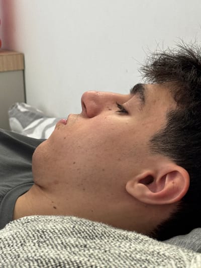 The image presents a close-up, right-side profile of a male individual's head and upper torso, situated in Ness Ziona, Israel. The person is depicted lying down, with eyes closed, indicating a state of sleep or rest. Key features include short, dark, somewhat unruly hair, visible stubble along the jawline and chin, and several small moles or freckles on the face and neck. The individual is dressed in a dark gray t-shirt and is resting on a textured gray fabric, consistent with a blanket or pillow. The background reveals a plain, light-colored wall, a partially visible light-toned furniture unit with a subtle reddish object on its surface, and a striped textile item, likely another pillow or blanket. The environment appears to be an indoor setting, illuminated by soft, diffuse lighting.