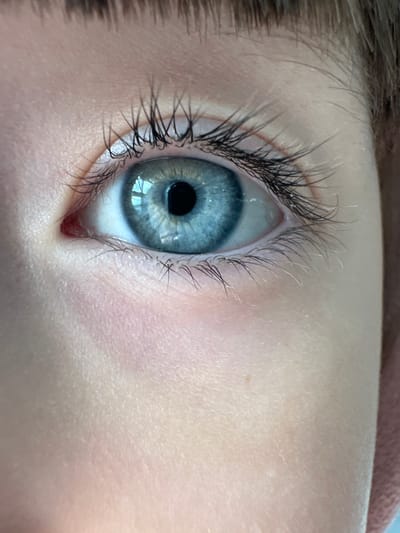 The image is a close-up of a human eye, likely belonging to a child or young adult. The eye has a light blue iris and a dark pupil. Prominent eyelashes are visible, along with a small red area in the inner corner of the eye, possibly indicating irritation. The skin around the eye is fair and shows fine wrinkles and pores. There is no evidence in the image that can lead to the assumption that the image was taken in the city of Kitsjanovo, Russia.
