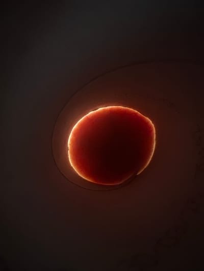 The media file is a close-up, illuminated shot of what appears to be an egg yolk against a dark background. The yolk is a deep red-orange color and is surrounded by a bright, glowing halo of light, suggesting it is being transilluminated. The texture of the yolk's surface is visible, with some fine lines or veins appearing on its upper edge. The background is dark and indistinct, with subtle variations in shading that hint at a curved surface or a slightly out-of-focus surrounding element. The lighting creates a dramatic contrast, drawing the viewer's attention to the luminous yolk. There is no visible text in the image. The overall mood is somewhat abstract and contemplative, focusing on the internal structure and light-passing properties of the egg yolk. The context of Letterkenny, Ireland, does not provide specific visual cues within the image itself.