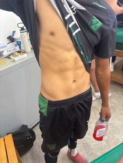 The image depicts an indoor scene set in a sports facility, specifically within the city of Las Crucitas, Mexico, likely a locker room or medical area.
A male individual is shown from the upper torso to the mid-thigh, standing and facing slightly to the right. His dark athletic shirt, featuring green and white design elements and a crest with a soccer ball and text, is pulled up, exposing his abdomen and lower chest. A small, linear cross tattoo is present on his right inner forearm. He is wearing black athletic shorts with green side panels and an elastic waistband, displaying a "LEON" logo on the left thigh. Black compression sleeves or shin guards are visible on his lower legs, above white socks and pink athletic shoes. In his right hand, he holds a clear plastic water bottle and a red bottle labeled "Electrolit".
On a light gray cabinet to the left, various medical and hydration supplies are arranged: white boxes labeled "AMBIDERM", "UniSeal", and "Quirmex/CASA", alongside a white insulated bottle with a black lid, and a small white electronic device with a yellow cable. A black "CHARLY" branded backpack rests on the tiled floor in the lower left, adjacent to a wooden surface. In the background right, the lower legs and feet of another individual, wearing white socks and athletic shoes, are partially visible, situated near a green cushioned bench. The floor is tiled.