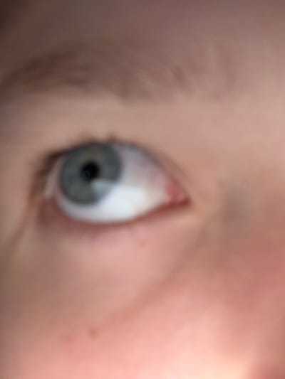 The image is a close-up, out-of-focus shot of a human eye. The eye has a light blue iris with a dark pupil. The surrounding skin is light-toned. There are no discernible background elements or environmental context. The image is entirely abstract and lacks any specific location information, therefore it cannot be linked to any city, country, or region.