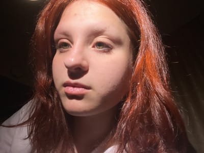 The image is a close-up, dimly lit portrait of a young person with reddish-brown hair. The subject is looking to the left, with the right side of their face illuminated by a bright light source, casting shadows on the left side of their face and nose. There is a visible pimple on the forehead. The background is dark and indistinct. The subject is wearing a white garment, possibly a shirt or top. The scene appears to be indoors, with no discernible features of the city of ЖК «Борисоглебское», Russia.