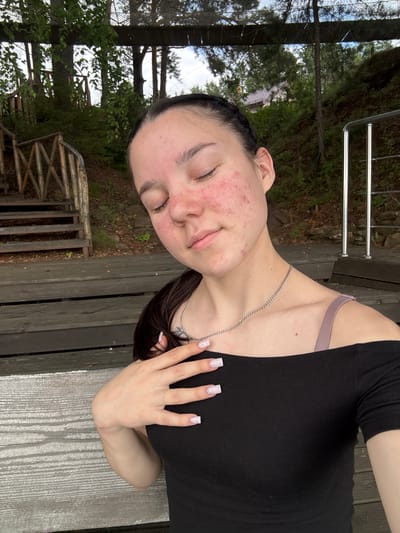 The media file shows a close-up, horizontally oriented shot of a young person, possibly a woman, with their eyes closed and a relaxed expression. They are wearing a black top with a light purple bra strap visible. A silver chain necklace is around their neck. Their hand, with manicured nails featuring a light, speckled design, is resting on their chest. The person has braided dark hair and visible acne on their face, particularly on the cheeks.
The background suggests an outdoor setting, possibly a park or a wooden deck, with trees and foliage visible. A wooden railing is present in the lower left of the frame, and what appears to be another wooden structure further back. The lighting suggests it might be daytime. The overall mood is tranquil and candid. There is no visible text in the image.