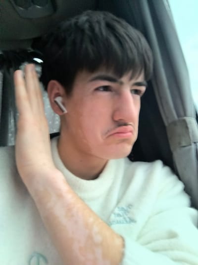 The image depicts a young male subject inside a vehicle in Mlada Gvardia, Bulgaria. The subject has short, dark hair with a fringe and appears to be a teenager or young adult. He wears a light-colored, possibly cream, long-sleeved sweater with a subtle light blue or grey embroidery on the right chest. A white wireless earbud is present in his left ear. His left forearm, visible in the foreground, exhibits distinct patches of hypopigmented skin. The subject's face is turned slightly to his right, with eyes directed off-camera. His lips are pursed into a pout, and a thin, dark mustache is visibly drawn above his upper lip. His eyebrows are dark and prominent. His left hand is raised vertically next to his left temple, palm facing the viewer. The background on the left consists of a dark vehicle interior component, while the right side shows a blurred exterior view through a window, revealing a light blue sky and a dark interior trim piece.
