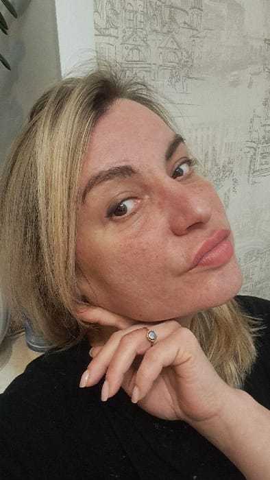 A female individual is depicted in a close-up indoor portrait, presumed to be a selfie, located in the city of Bel'kovo, Russia. The subject is an adult female with blonde hair, appearing lightened with darker roots and some loose strands. Her skin tone is light, exhibiting visible pores and localized redness on the nose and cheeks. Her dark brown eyes are directed towards the camera, with a thin line of dark eyeliner on the lower lash line. Her eyebrows are dark and shaped. Her lips are full, colored with light pink lipstick, and positioned in a puckered expression. She wears a black garment, visible on her shoulder and chest. Her left hand is positioned with fingers resting against her chin and jawline; the visible fingernails are manicured with a pale, natural polish. A ring with an oval, light-colored stone, possibly opalescent, is present on her left ring finger. The background consists of a wall covered with wallpaper featuring a monochromatic, illustrated urban cityscape design, including various architectural structures and faint outlines of vehicles. A blurred green object, consistent with foliage, is visible in the upper left quadrant of the image. The scene is illuminated by direct, likely artificial, light.