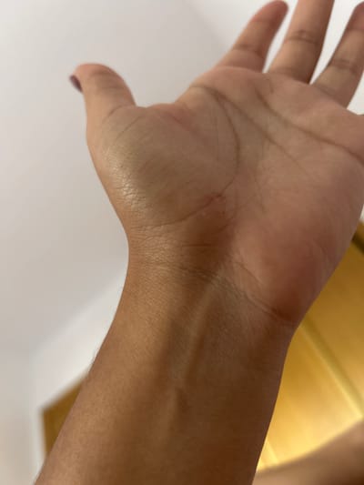 The image shows a close-up view of a person's left wrist and palm. The skin is light brown and shows prominent veins on the wrist. There appears to be a small, reddish abrasion on the palm near the base of the thumb. The background is out of focus, with a white wall on the left and a wooden surface on the right, suggesting an indoor setting. The angle of the shot is from below, looking upwards towards the hand and wrist.
