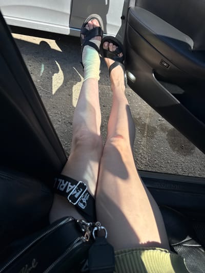 The image shows a person's legs inside a vehicle. The left leg is bandaged around the ankle and lower calf with a light-colored wrap, possibly an elastic bandage, that transitions to a pale greenish-yellow hue at the top. The person is wearing a black sandal on this foot. The right leg appears to have a reddish-brown abrasion or scrape on the knee area. The person is also wearing a black strap around the upper calf of the right leg, with white text that appears to be "KARL" and a skull graphic. A black bag with silver hardware is visible in the lower portion of the image, with a strap that also has the "KARL" text. The interior of the car, with black leather upholstery and door panel, is visible. The exterior of the car shows a grey door. The ground outside the vehicle appears to be dirt or gravel, with sunlight casting shadows. The scene is consistent with someone sitting in a car, possibly having sustained injuries to their leg. The location is not discernible from the image itself.