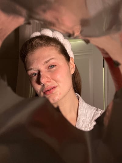 The image displays a young adult female subject, located in Matiushino, Russia, observed through the irregular opening of a dark, possibly metallic or foil-lined, flexible container or bag that frames the central view. The subject has light brown hair pulled back, held in place by a light-colored, segmented, terry cloth-like headband. She is wearing a light-colored, vertically striped garment, consistent with a bathrobe or pajamas. Her face, illuminated directly, exhibits some redness on the cheeks and nose, with a notable blemish on the lower right side of her chin/jaw. A white or translucent facial product is visible on her forehead, nose, and upper cheekbones. Her blue-green eyes are directed towards the viewer, and her lips are slightly parted. The background reveals a dimly lit indoor setting, with a white door and doorframe partially visible to the viewer's right.