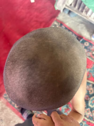 The image provides a close-up, top-down view of a person's shaved head. The skin on the scalp is visible with short, dark hair. The background is blurred, but appears to show a red fabric surface and a patterned rug with red, blue, and green elements. There is also a hint of a radiator or similar object in the upper right portion of the image, suggesting an indoor setting. The lighting is moderate, with some shadows cast on the head. The perspective is from above, looking down onto the subject's head. No specific location within International, Kyrgyzstan can be determined from the visual information.