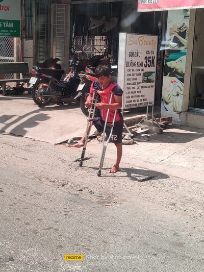 In the city of Ben Cau, Vietnam, a young man with a disability, using crutches to support himself, walks along a cracked concrete sidewalk. He is wearing a red and blue striped t-shirt and dark shorts with the number "92" on the left leg. A motorbike is parked behind him. To his right, a sign displays "Su Beauty" services, including hair washing, facials, and massage, with prices listed in Vietnamese Dong. The scene is bathed in bright sunlight, casting strong shadows on the ground.