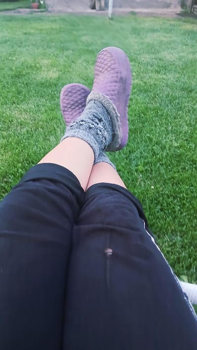 The image shows a close-up view of a person's legs from the knees down, resting on a green lawn. The person is wearing black shorts, gray patterned socks with fuzzy trim, and purple slip-on shoes. The shoes have a diamond-shaped tread pattern. The lawn appears to be well-maintained. There is a small tear in the right leg of the shorts, with a pinkish stain visible through it. In the background, a blurred view of what appears to be a yard with a potted plant and a fence can be seen, suggesting an outdoor setting. The image is taken from a slightly elevated angle, looking down at the legs. The scene is likely set in Nadezhdenka, Russia, as indicated.