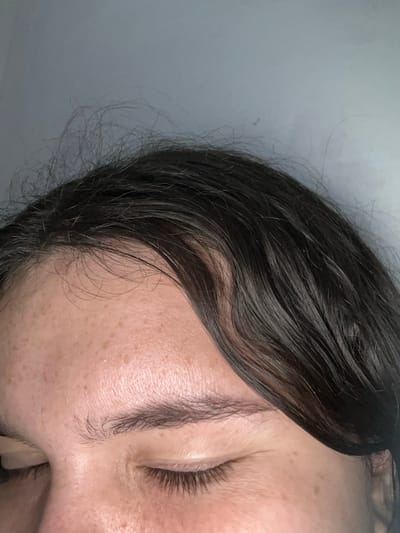 The image shows a close-up of a person's face. The person has dark hair that is styled to the side. Their eyes are closed, and their skin has freckles. The background is a plain grey wall. The location of San Juan de Los Morros, Venezuela is unknown.