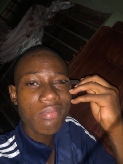 A person lies on their back in an indoor setting. The person is dark-skinned, wearing a blue shirt with white stripes on the sleeves. A hand holds a black object near the person's face, possibly touching the forehead. The background shows a brown object and a white, patterned object. The setting is indoors. The location in the city of Atani, Nigeria is unknown.