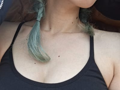 A close-up, slightly angled shot of a person's upper torso and neck. They are wearing a black tank top. Their hair is dyed a light blue-green and is braided on both sides of their face. Several moles are visible on their neck and chest. The background is out of focus and provides no discernible context regarding location. The scene is not in Tlik, Armenia; there are no indications or evidence supporting this location.