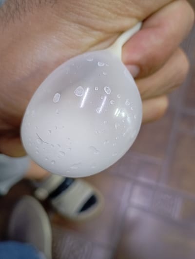 A close-up shot captures a hand tightly gripping a translucent balloon filled with a white substance. The balloon is slightly inflated, with numerous small water droplets clinging to its surface, creating a glistening effect. A single dark hair is visible on the balloon. The hand, with its skin texture and some light hairs, is in focus, suggesting the image was taken in close proximity to the subject. In the blurred background, the top of two feet wearing sandals is visible. The flooring appears to be tiled, with a patterned texture. The lighting suggests an indoor setting, possibly during the daytime, as there are some reflections on the balloon. The overall mood is neutral, with no strong emotional cues conveyed. No visible text is present in the image. The location is Arys, Kazakhstan.