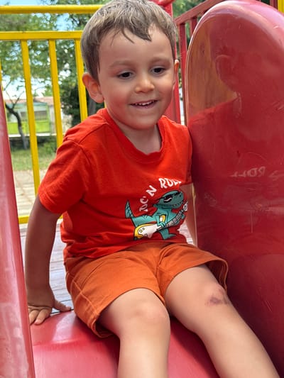 The image captures a young boy sitting on a red slide in an outdoor playground. The boy is wearing an orange t-shirt with a graphic of a dinosaur playing a guitar and orange shorts. His left knee exhibits a bruise. The background reveals a yellow railing, trees, and a building, suggesting a park or a similar recreational area. The scene is set in the city of Vinarsko, Bulgaria.