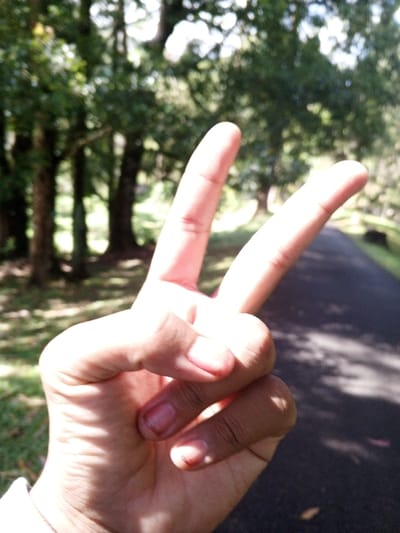 The image primarily features a human hand making a peace or victory sign, with the index and middle fingers extended upwards and the thumb, ring, and pinky fingers curled into the palm. The hand is in sharp focus and exhibits a light-to-medium skin tone, with visible fingernails on the thumb, index, and pinky fingers.
The background is softly blurred, suggesting a shallow depth of field, and depicts an outdoor natural environment. Numerous trees with green foliage are visible, indicating a wooded area or a treelined path. On the right side of the frame, a dark-colored paved path or road recedes into the distance.
The lighting suggests it is daytime, likely a sunny day, with bright natural light illuminating the hand and casting distinct shadows on its underside and around the fingers. The overall activity shown is a person making a hand gesture. No visible text is present in the image. The scene conveys a calm, outdoor setting, consistent with natural landscapes found in Burauen, Philippines.