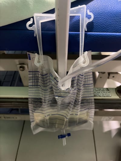 The image shows a close-up, low-angle view of a medical urine collection bag hanging from a metal frame, likely in a hospital or healthcare setting. The bag is partially filled with a pale yellow liquid, with measurement markings visible in blue indicating volumes of 500ml, 1000ml, 1500ml, and 2000ml. A clear plastic tube is connected to the top of the bag. The bag is suspended by two clear plastic hooks attached to a white vertical pole. In the background, a blue padded surface, possibly a hospital bed or chair, is visible. The overall lighting suggests an indoor environment. There is no indication of the city of Pekalongan, Indonesia, or any specific location within it.