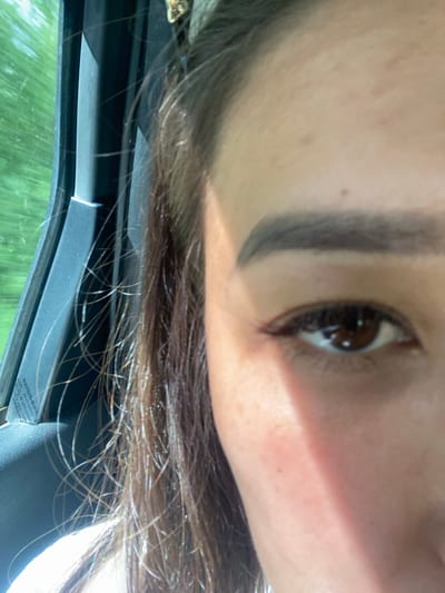 A close-up, waist-up, eye-level shot captures the right side of a person's face and shoulder, viewed from the perspective of someone sitting in a vehicle. The person, whose gender is not definitively ascertainable but appears to be female, has dark hair that is partially visible on the left side of the frame, with fine strands catching the light. The individual's right eye is the focal point, with a dark brown iris and visible eyelashes. The skin tone is fair, with some reddish flush on the cheek and a few small blemishes visible on the forehead. A shadow crosses the face from the right, highlighting the cheekbone and the bridge of the nose.
The background suggests the person is inside a vehicle, evidenced by the black car interior framing the left side of the image, including a portion of a window with a faint "NISSAN" logo visible. Outside the window, a blurred green landscape indicates movement, suggesting the vehicle is in transit. The overall lighting is bright, likely from sunlight. The image does not contain information to determine the location in the city of Tyulyugul, Russia.