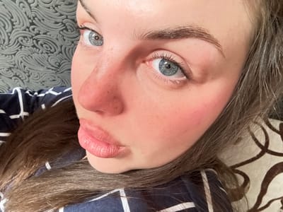 A selfie of a woman with fair skin and blue eyes. She has light brown hair and her lips are glossy. The woman is lying down, with a striped shirt and a patterned pillow visible behind her. The background also includes a grey patterned surface. There is no indication in the image that this scene is located in Chornomorskoe, Ukraine.
