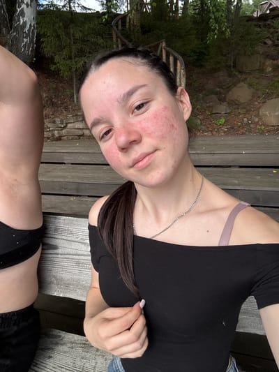 A young woman with dark hair pulled back in a braid is seated on a wooden bench outdoors. She is wearing a black off-the-shoulder top and denim shorts. Her face is flushed and appears to have some redness or irritation on her cheeks. A silver chain necklace is visible around her neck. To her left, a portion of another person's torso is visible, wearing black shorts. The background consists of a wooden structure, trees, and rocks, suggesting a natural, possibly rural setting. The image appears to be a selfie taken at a slight upward angle. The location is identified as Pozdyshki, Russia.