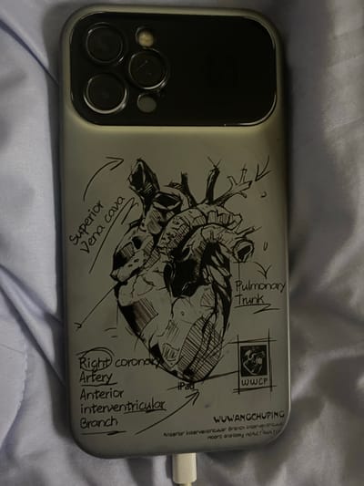 A phone case is lying on a light blue fabric surface. The phone case is light gray and has a black sketch of a human heart on it. Various parts of the heart are labeled with handwritten text in black ink, including "Superior Vena cava", "Pulmonary Trunk", and "Right coronary Artery Anterior interventricular Branch". There is also a small square logo with a heart inside and the letters "WWCP" below it. Below the heart sketch, there is a name handwritten, "WOWANGCHUPING", and further text that appears to be "Anterior interventricular Branch interventricula heart anatomy HEART ANATOMY". The phone's camera module is visible at the top of the case. The fabric surface appears to be a piece of clothing or bedding. There is no indication of the city of Istaravshan, Tajikistan, in the image.