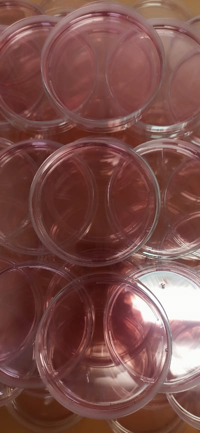 The image shows a close-up, overhead view of a pile of clear plastic petri dishes. The dishes are stacked and overlapping, creating a pattern of circles and rings. Some of the dishes appear to have a faint pink or reddish tint, possibly from a liquid or media inside, or from the lighting. The lighting is bright and reflective, causing highlights and glare on the plastic surfaces. There are no people visible in the image. The setting appears to be an indoor environment, likely a laboratory or a clean room, given the nature of the objects. The activity taking place is simply the storage or presentation of these petri dishes. Notable details include the translucent nature of the dishes, the stacked arrangement, and the presence of reflections. There is no visible text in the image. The location context of Asbest, Russia, does not provide any specific visual cues within the image itself.