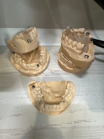 The image shows three dental models. The models are made of plaster or similar material and represent upper and lower sets of teeth. One model is partially assembled with two clear plastic tubes connected to it. The models are on a light-colored surface, likely a table or countertop, with a vertical, wood-grain patterned background. The location in Kraskovo, Russia, is not evident from the image.