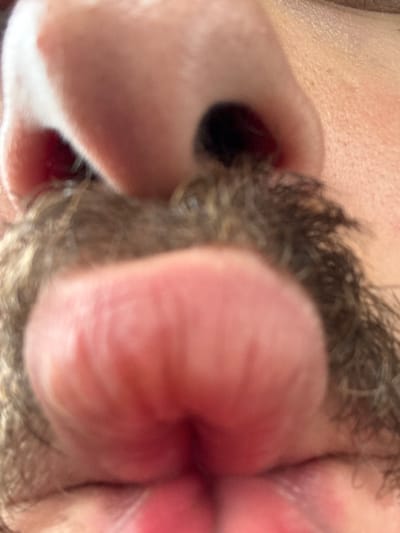 The image presents an extreme close-up, upward-angled view of a human face, focused primarily on the nose, moustache, and mouth area. The upper portion of the frame shows the underside of a light-toned nose with two prominent, dark nostrils. Immediately below the nose, a thick, dense moustache is visible, composed of a mixture of dark brown and lighter-colored hairs. Below the moustache, the upper lip is prominently featured, appearing full, pinkish-red, and slightly pursed, exhibiting vertical ridges. A portion of the lower lip, also pinkish-red, is visible at the bottom edge of the frame. The surrounding skin is light-toned, showing minor texture and pores. No environmental details are discernible to establish a location within Anzola dell'Emilia, Italy, or any other geographical area.