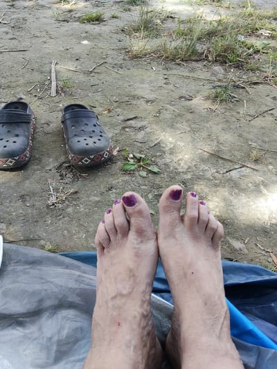 The media file shows a close-up view of a person's feet, resting on what appears to be a blue and grey tarp or groundsheet. The feet are bare and have purple nail polish on the toes. The skin shows some texture and veins. There are two black Crocs-style shoes in the background, placed on a dirt and grassy ground. The shoes have decorative patterns around the soles. The ground is a mix of soil, dry leaves, and sparse vegetation, suggesting an outdoor setting. Sunlight filters through the scene, creating some shadows, which might indicate it's daytime. The overall impression is one of relaxation and casual outdoor activity. There is no visible text in the image. The location context provided is Bilyaivka, Ukraine.